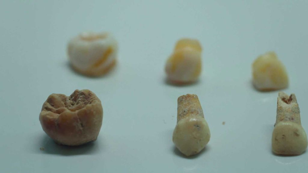 Co o pravěkých dětech prozradil výzkum mléčných zubů