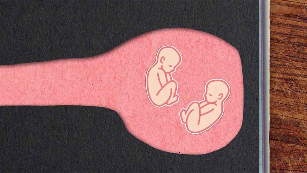 Jak je to s dvojčaty