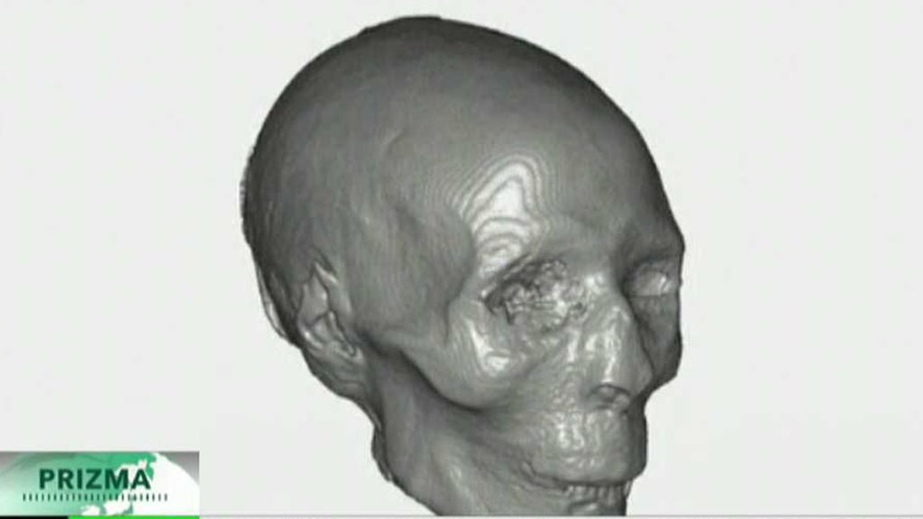 3D mumie