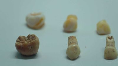 Co o pravěkých dětech prozradil výzkum mléčných zubů