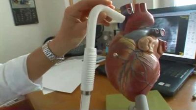 Jak funguje umělé srdce?